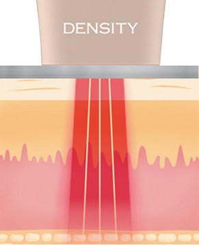 upic density