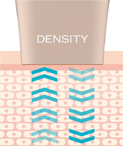 upic density
