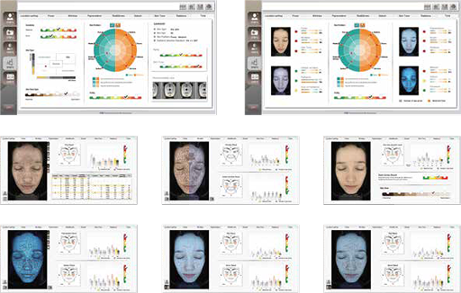 upic excel_v