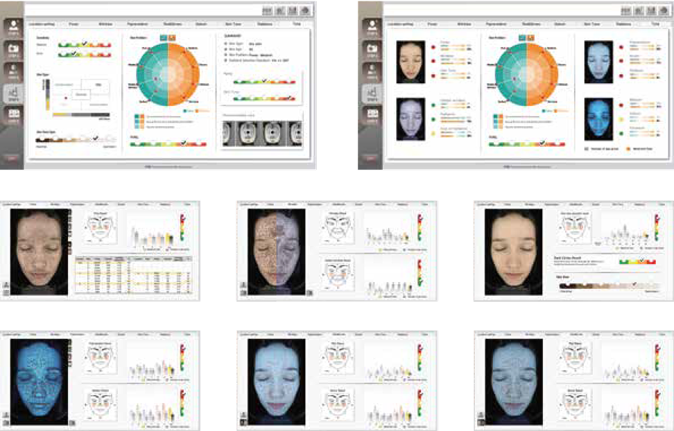 upic excel_v